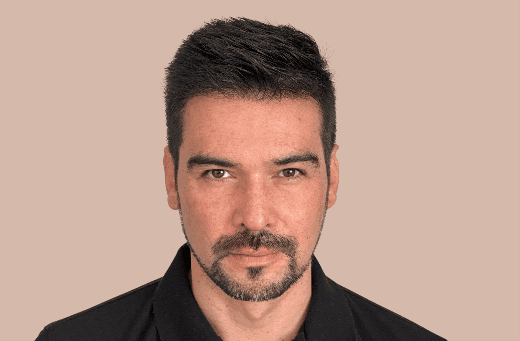 Implante David Despues