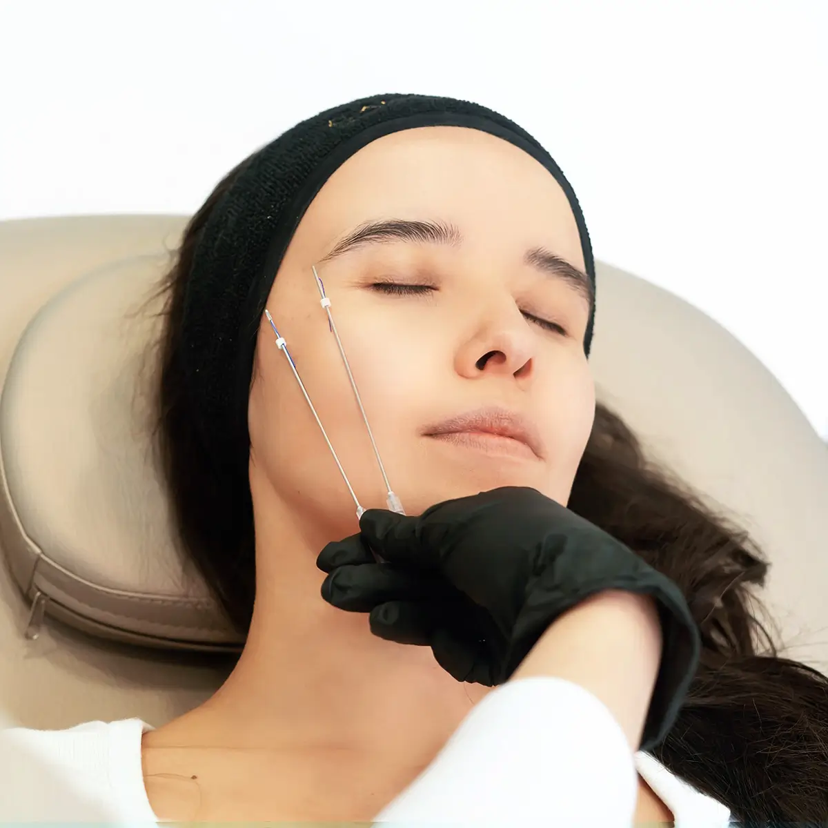 canvasskin servicio rejuvenecimiento facial y armonizacion hilos tensores